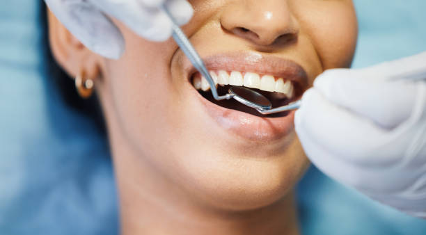 Best Emergency Broken Tooth Repair in Brunswick, OH